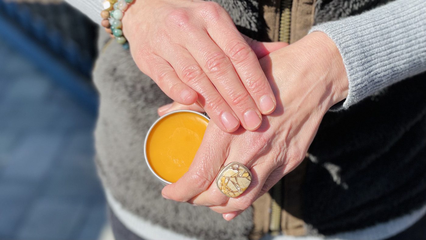Nicole Apelian using salve on hands Nicole Apelian using salve on hands
