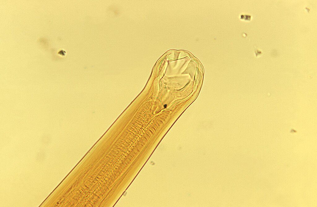hookworm magnified