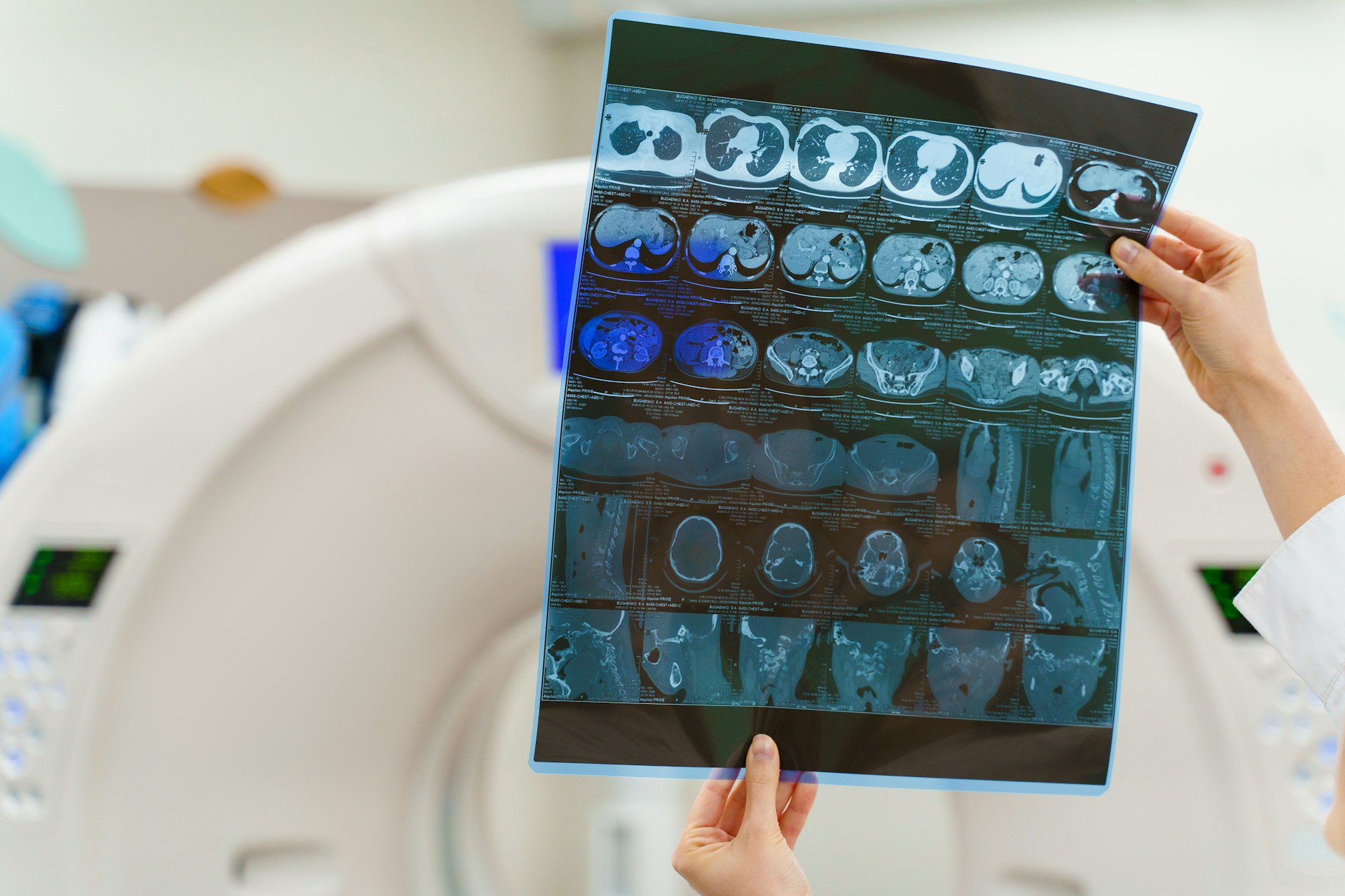 MRI scans