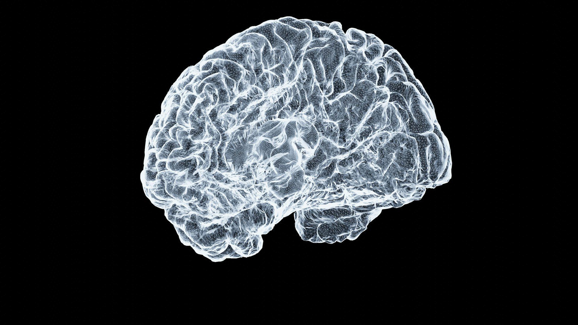 brain scan